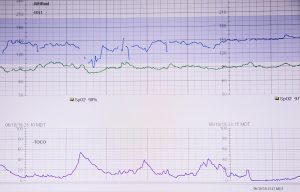 Photo NetSpeedMonitor - A tool for monitoring internet speed
