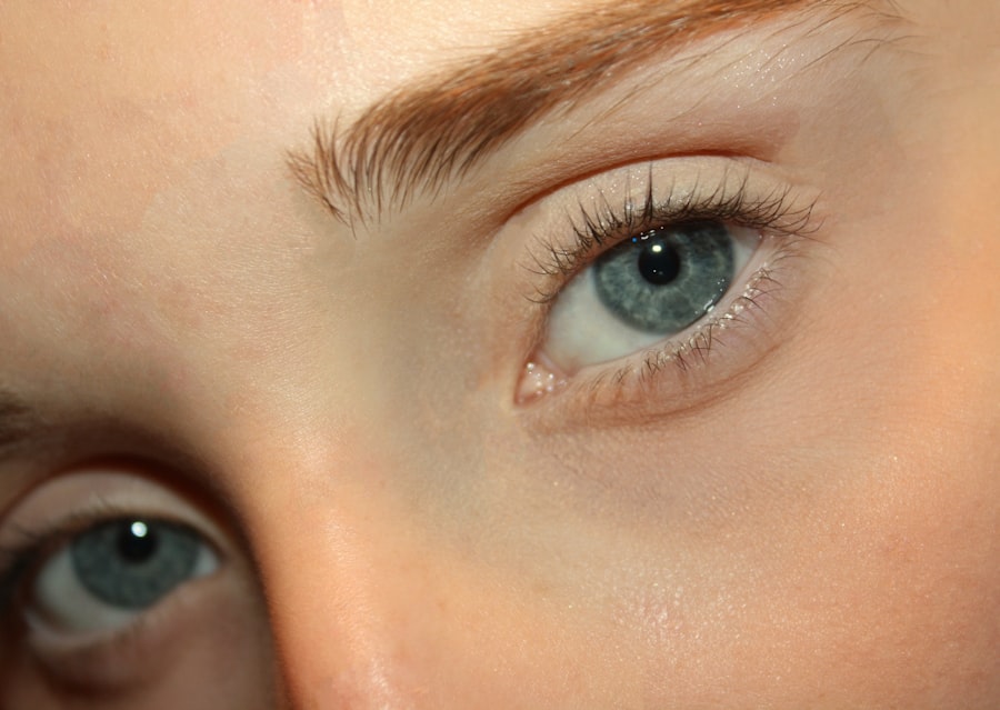 Photo reduce eye strain