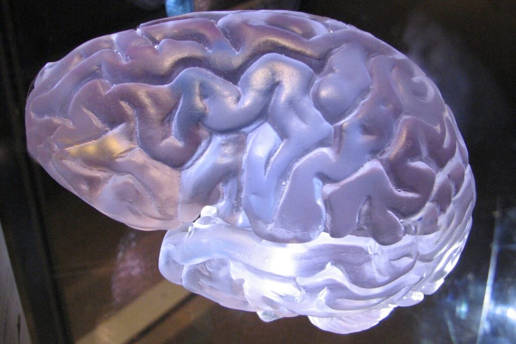 Photo music and brain